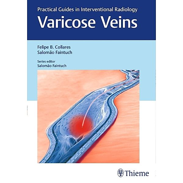 Varicose Veins: Practical Guides in Interventional Radiology, Felipe Collares, Salomao Faintuch