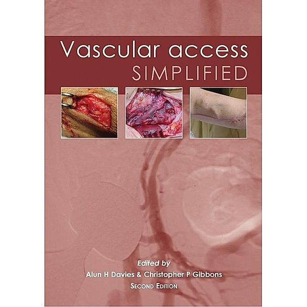 Vascular Access Simplified; second edition, Alun, H Davies