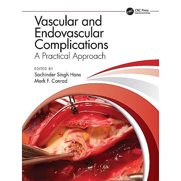 Vascular and Endovascular Complications: A Practical Approach
