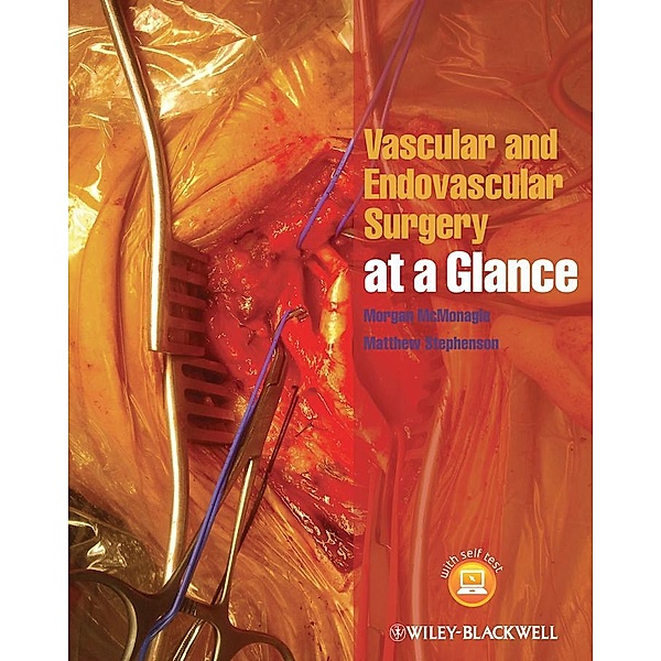 Vascular and Endovascular Surgery at a Glance / At a Glance, Morgan McMonagle, Matthew Stephenson