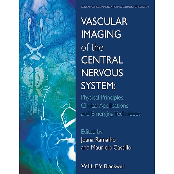 Vascular Imaging of the Central Nervous System / Current Clinical Imaging, Mauricio Castillo, Joana Ramalho