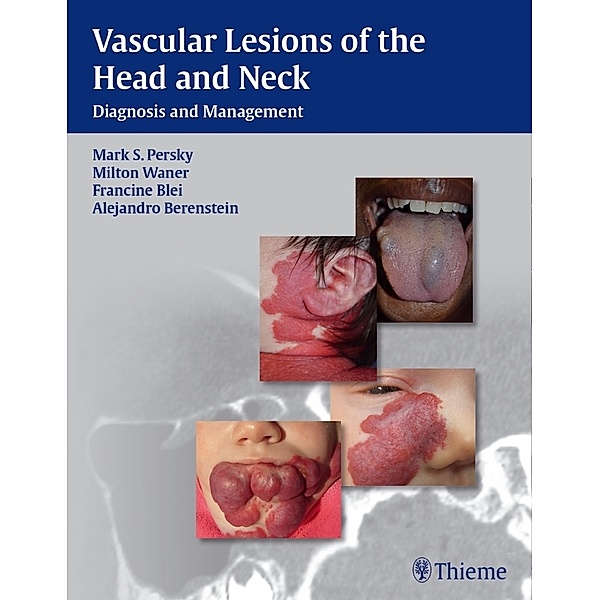 Vascular Lesions of the Head and Neck, Mark S. Persky, Milton Waner, Francine Blei, Alejandro Berenstein