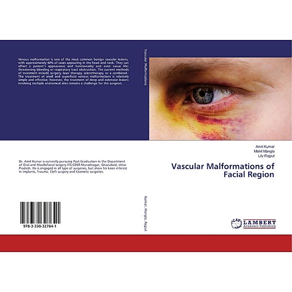 Vascular Malformations of Facial Region, Amit Kumar, Mohit Mangla, Lily Rajput