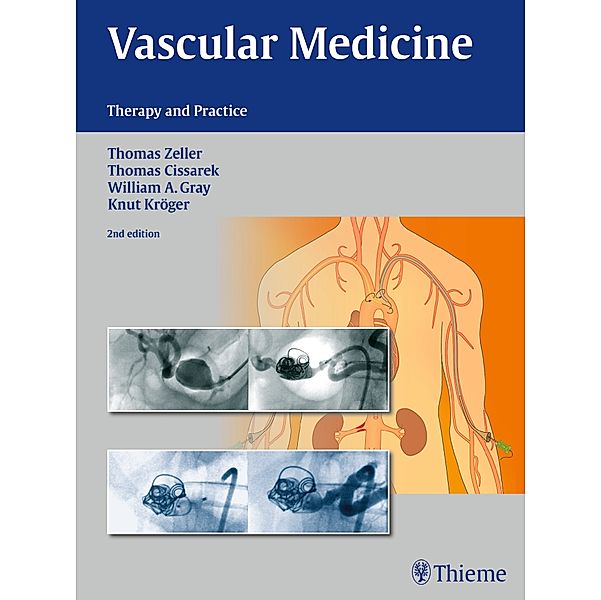 Vascular Medicine, Thomas Zeller, Thomas Cissarek, Knut Kroeger, William Gray, Knut Kröger