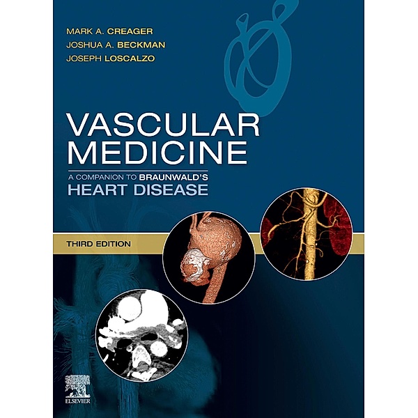 Vascular Medicine: A Companion to Braunwald's Heart Disease E-Book / Companion to Braunwald's Heart Disease, Mark Creager, Joshua A. Beckman, Joseph Loscalzo