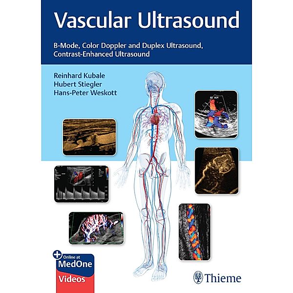 Vascular Ultrasound