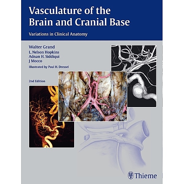 Vasculature of the Brain and Cranial Base, Walter Grand, L. Nelson Hopkins, Adnan H. Siddiqui, J. Mocco