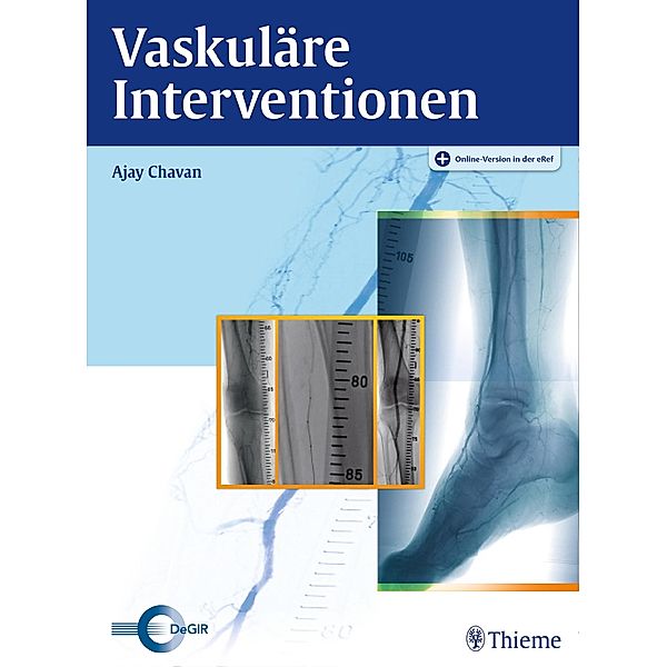 Vaskuläre Interventionen