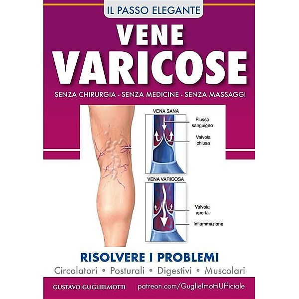 Vene varicose - Prevenire, ridurre ed eliminare, Gustavo Guglielmotti