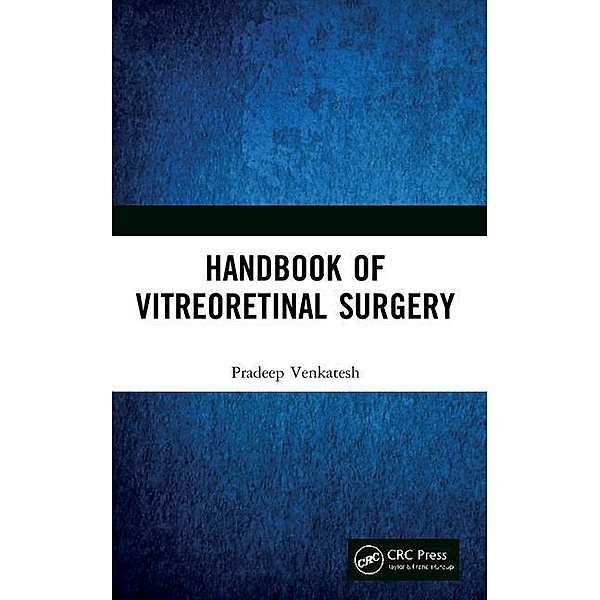 Venkatesh, P: Handbook of Vitreoretinal Surgery, Pradeep Venkatesh