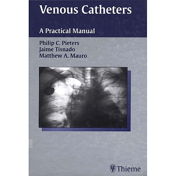 Venous Catheters, Philip C. Pieters, Jaime Tisnado, Matthew A. Mauro