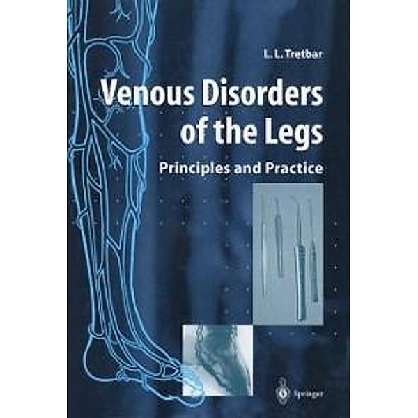 Venous Disorders of the Legs, Lawrence L. Tretbar