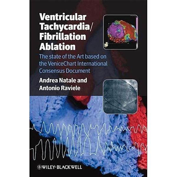 Ventricular Tachycardia / Fibrillation Ablation, Andrea Natale, Antonio Raviele