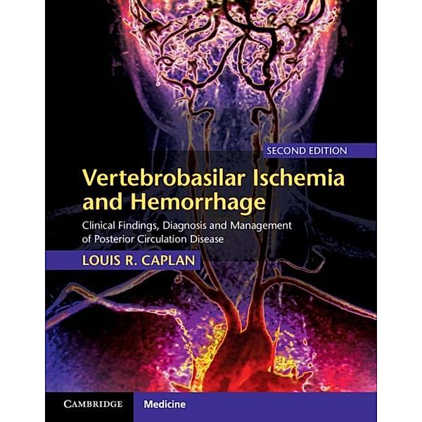 Vertebrobasilar Ischemia and Hemorrhage, Louis R. Caplan