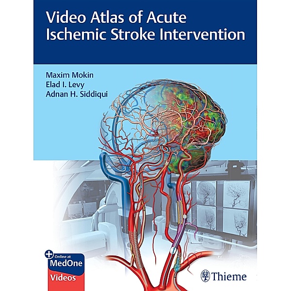 Video Atlas of Acute Ischemic Stroke Intervention, Maxim Mokin, Elad Levy, Adnan Siddiqui