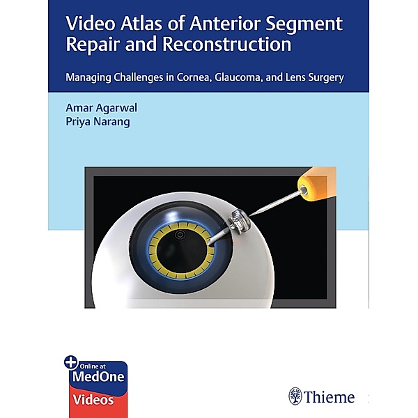 Video Atlas of Anterior Segment Repair and Reconstruction, Amar Agarwal, Priya Narang