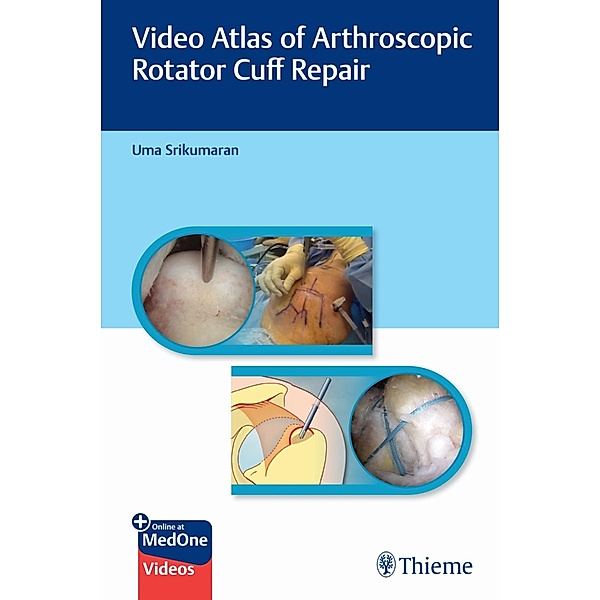Video Atlas of Arthroscopic Rotator Cuff Repair, Uma Srikumaran