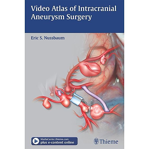 Video Atlas of Intracranial Aneurysm Surgery