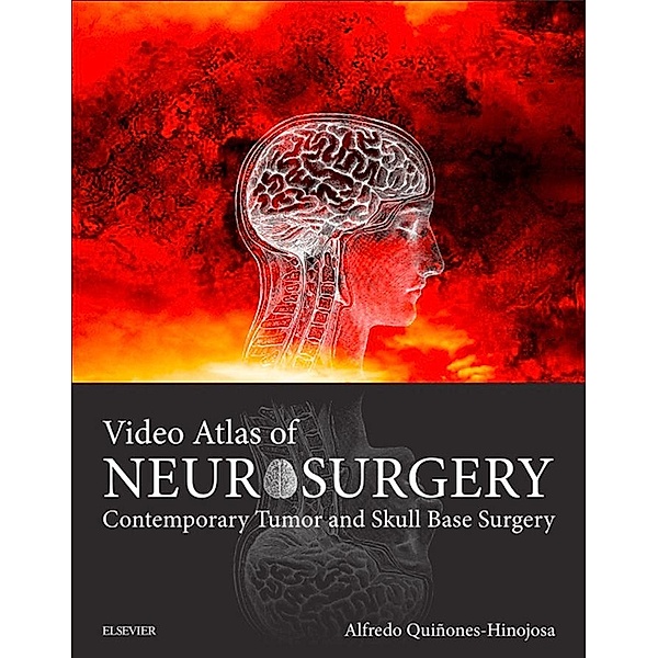 Video Atlas of Neurosurgery E-Book, Alfredo Quinones-Hinojosa