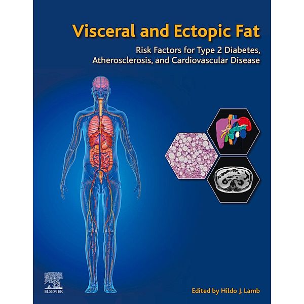 Visceral and Ectopic Fat