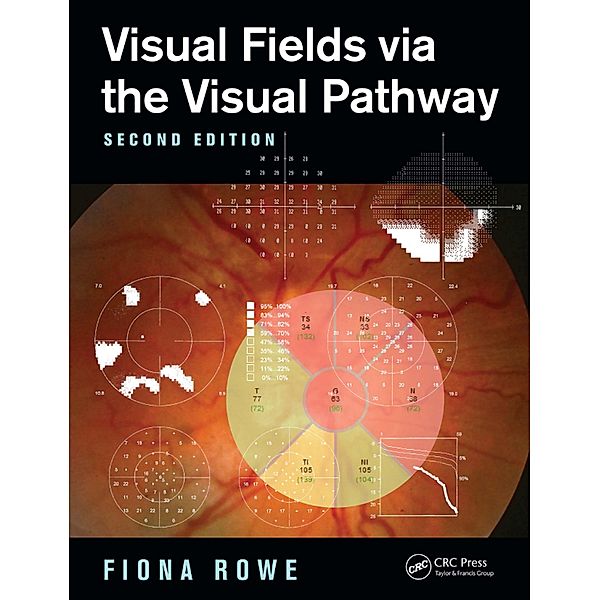 Visual Fields via the Visual Pathway, Fiona Rowe