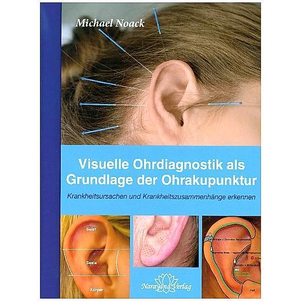 Visuelle Ohrdiagnostik als Grundlage der Ohrakupunktur, Michael Noack