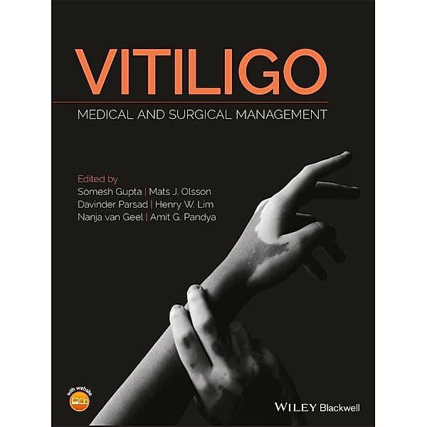 Vitiligo