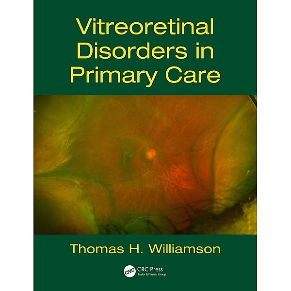 Vitreoretinal Disorders in Primary Care, Thomas H. Williamson