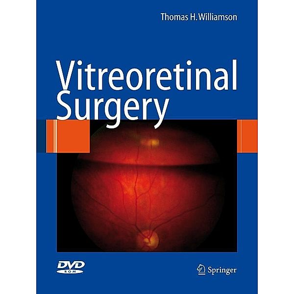 Vitreoretinal Surgery, Thomas H. Williamson