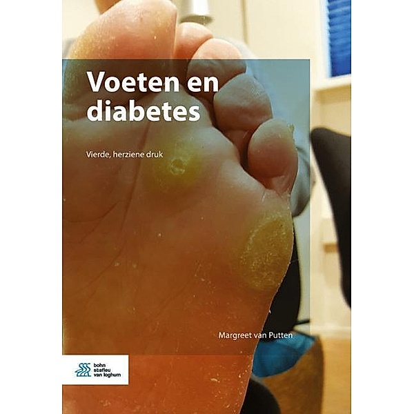 Voeten en diabetes, M. van Putten