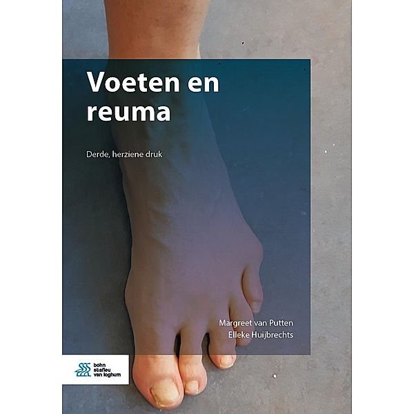 Voeten en reuma, Margreet van Putten, Elleke Huijbrechts