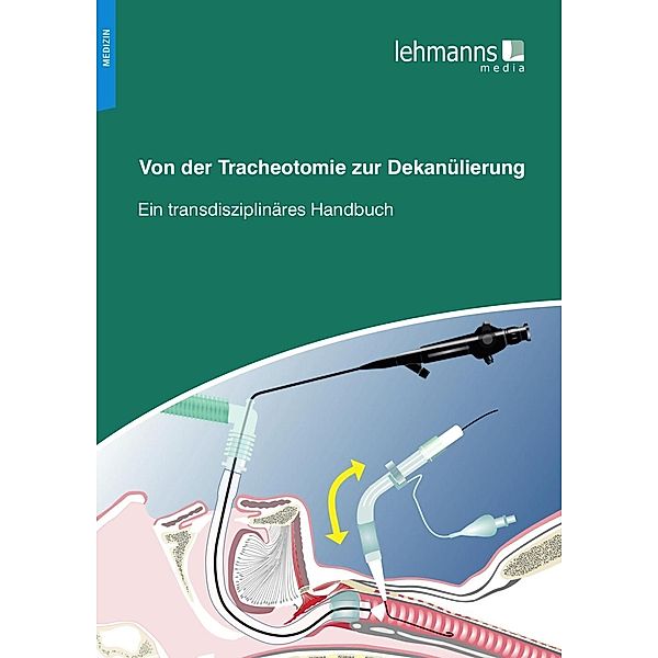 Von der Tracheotomie zur Dekanülierung