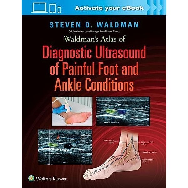 Waldman's Atlas of Diagnostic Ultrasound of Painful Foot and Ankle Conditions, Steven Waldman