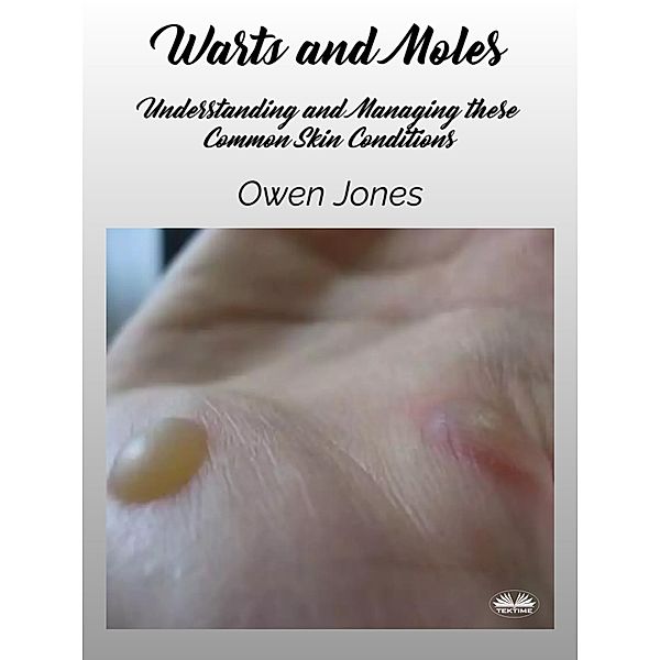 Warts And Moles, Owen Jones