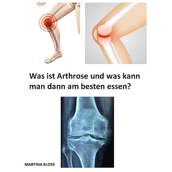 Was ist Arthrose und was kann man dann am besten essen?, Martina Kloss