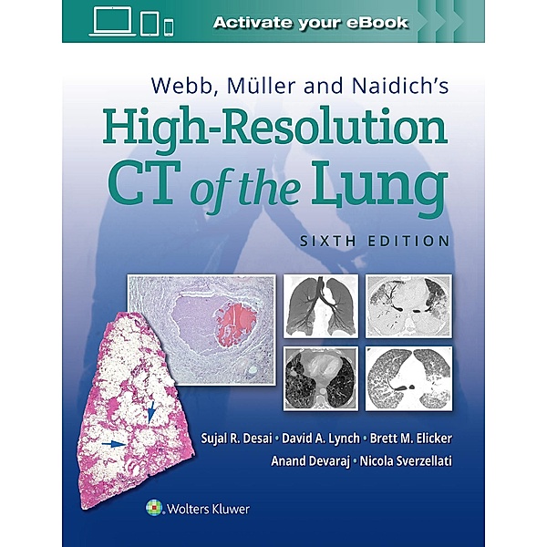 Webb, Muller and Naidich's High Resolution of Lung CT, Sujal Desai, David A. Lynch, Brett M. Elicker, Anand Devaraj, Nicola Sverzellati