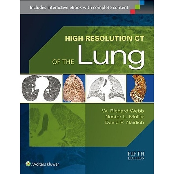 Webb, W: High-Resolution CT of the Lung, W. Richard Webb, Nestor L. Muller, David P. Naidich