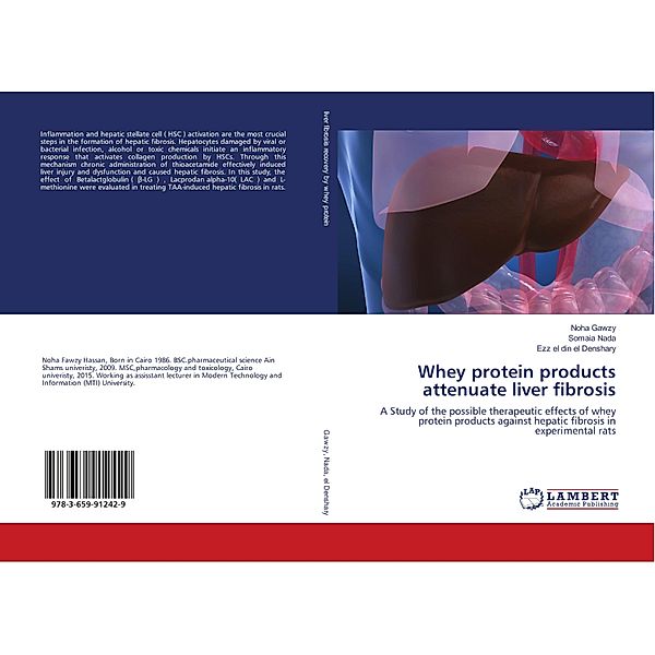 Whey protein products attenuate liver fibrosis, Noha Gawzy, Somaia Nada, Ezz el din el Denshary