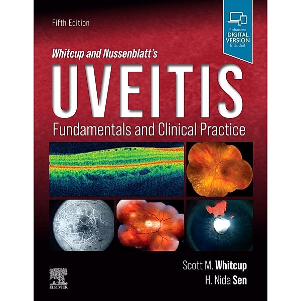 Whitcup and Nussenblatt's Uveitis, Scott M. Whitcup, H. Nida Sen
