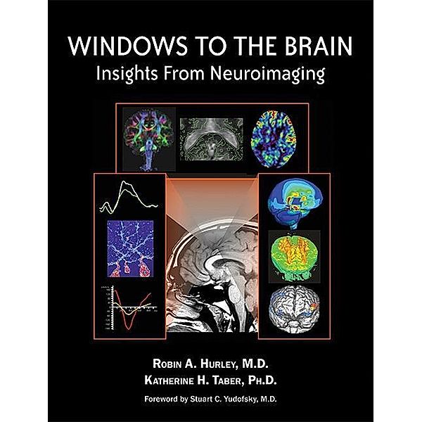 Windows to the Brain, Robin A. Hurley, Katherine H. Taber