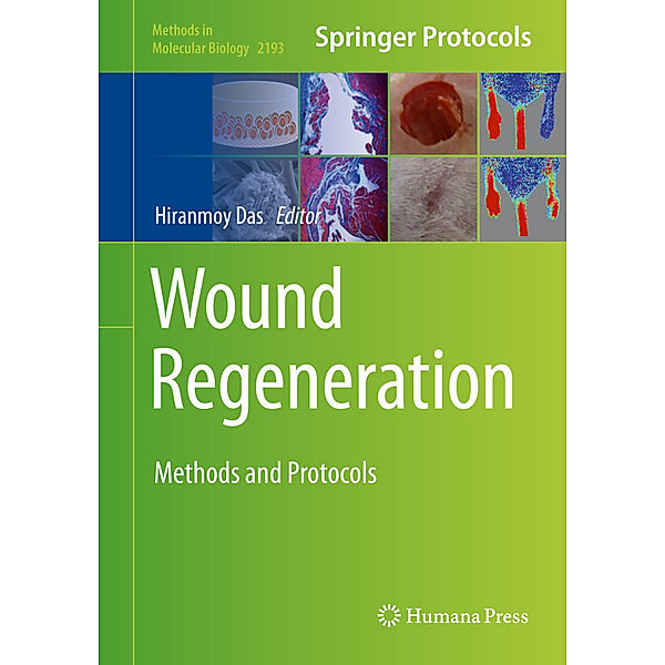 Wound Regeneration