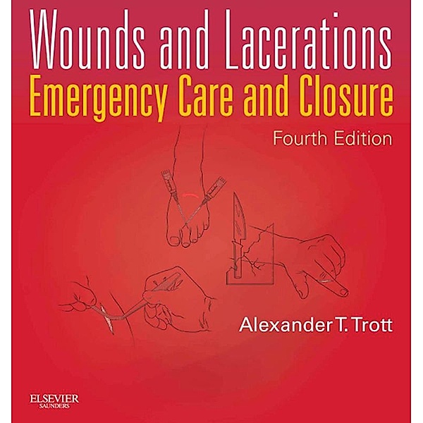 Wounds and Lacerations - E-Book, Alexander T. Trott