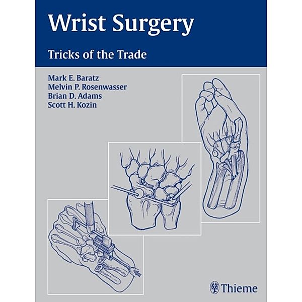 Wrist Surgery