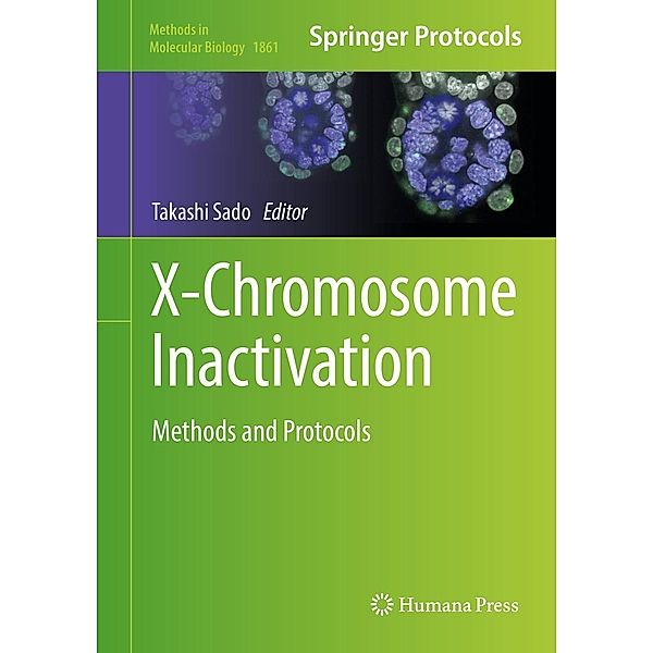 X-Chromosome Inactivation / Methods in Molecular Biology Bd.1861