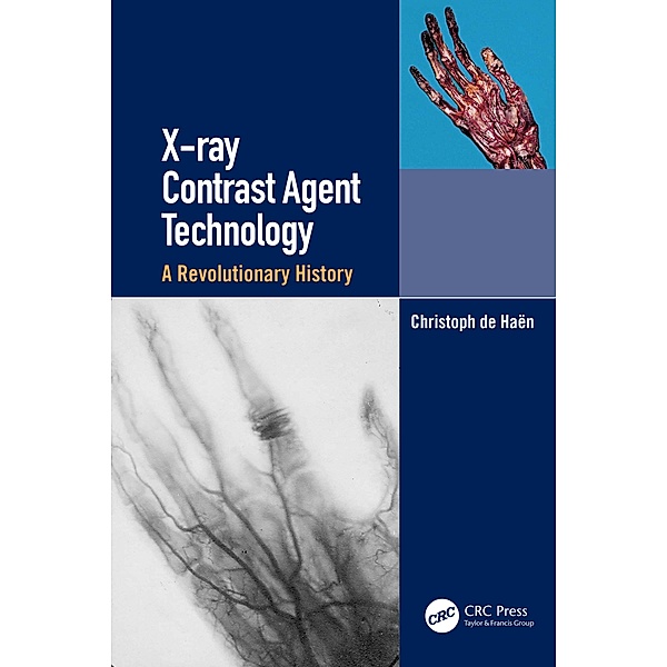 X-ray Contrast Agent Technology, Christoph de Haen