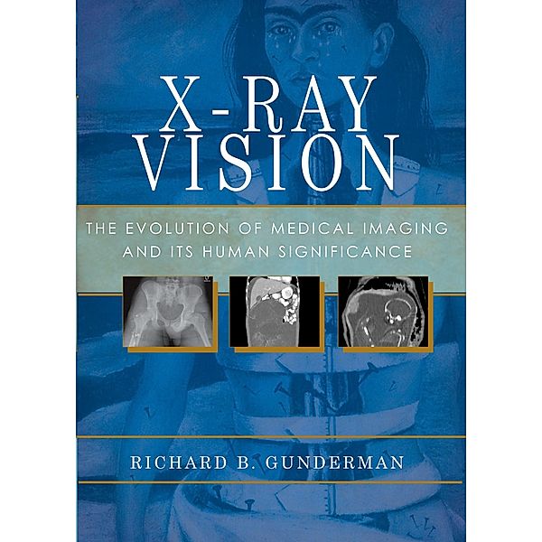 X-Ray Vision, Richard B. Gunderman
