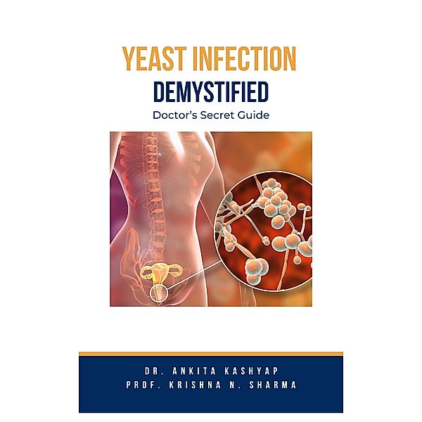 Yeast Infection: Demystified Doctor's Secret Guide, Ankita Kashyap, Krishna N. Sharma