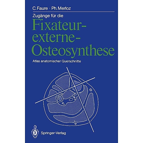 Zugänge für die Fixateur-externe-Osteosynthese, Claude Faure, Philippe Merloz